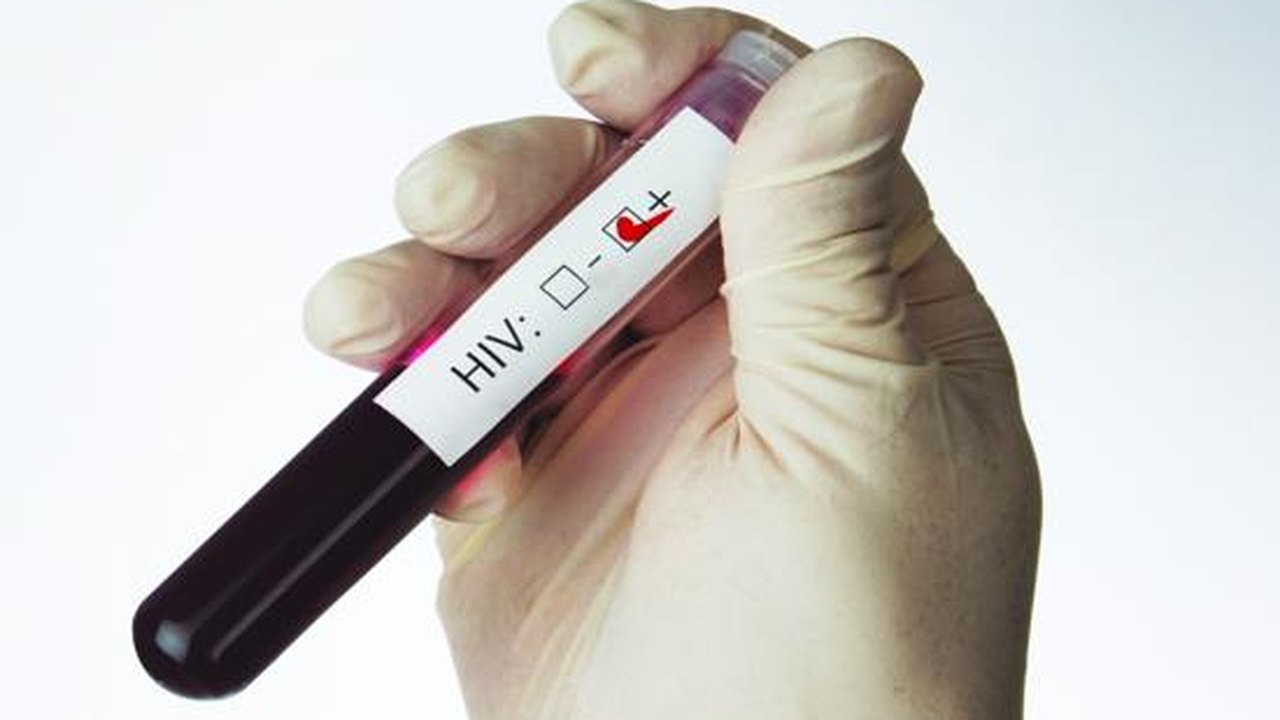 SUS terá teste rápido para aids feito com fluido oral em 2014