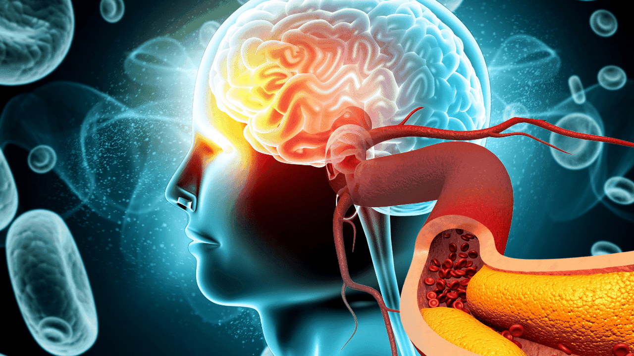 Dia Mundial do AVC: entenda como a saúde vascular ajuda a prevenir a doença