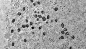 monkeypox_02