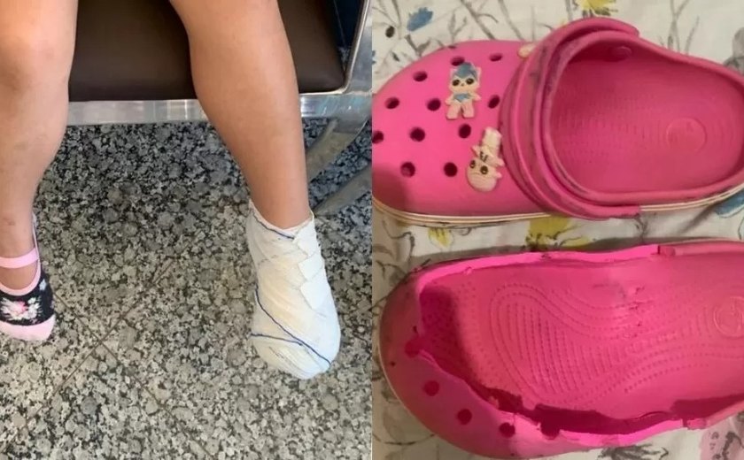Menina de 5 anos tem dedo do pé amputado após acidente em escada rolante de shopping em MS
