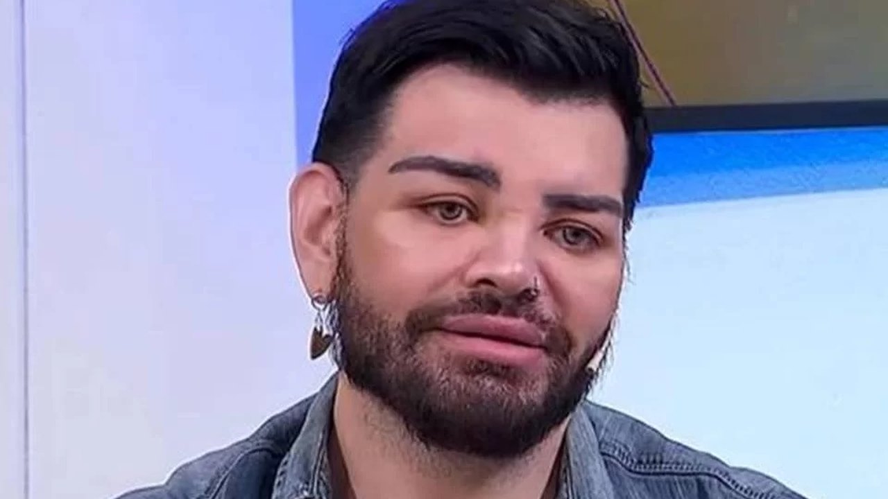 Ator argentino faz mais de 30 cirurgias para se parecer com Ricky Martin e quase perde a visão