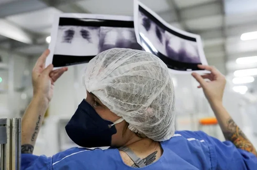 Diagnóstico tardio reduz chances de cura do câncer de pulmão