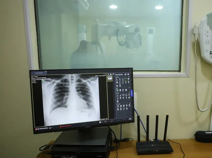 Brasil tem aumento de hospitalizações por Influenza A, alerta Fiocruz