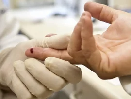 O que a história da AIDS nos ensinou sobre saúde, 45 anos depois?