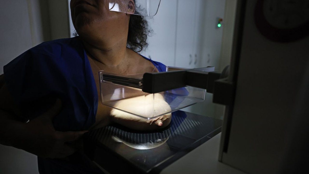ANS defende cobertura de mamografia digital sem restrição de idade