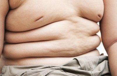 Gestores municipais têm até 17 de setembro para aderir à estratégia de prevenção a obesidade infantil