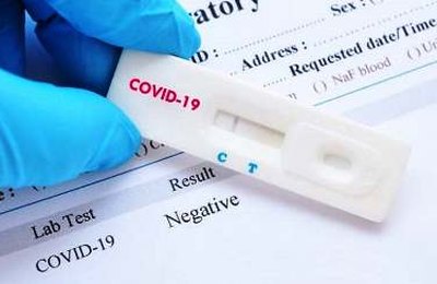 SEMS Penedo divulga Boletim Epidemiológico desta sábado (26)