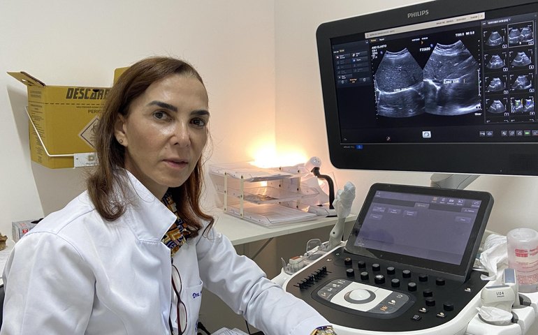 Cedim da Uncisal é a única unidade do SUS em Alagoas a realizar exame hepático não invasivo