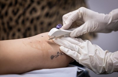 Gestão JHC marca avanço histórico na saúde da mulher com inserção gratuita do Implanon