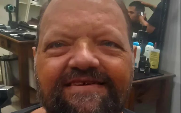 Complicações do diabetes: entenda a condição que levou à morte de Marcelo Pretto