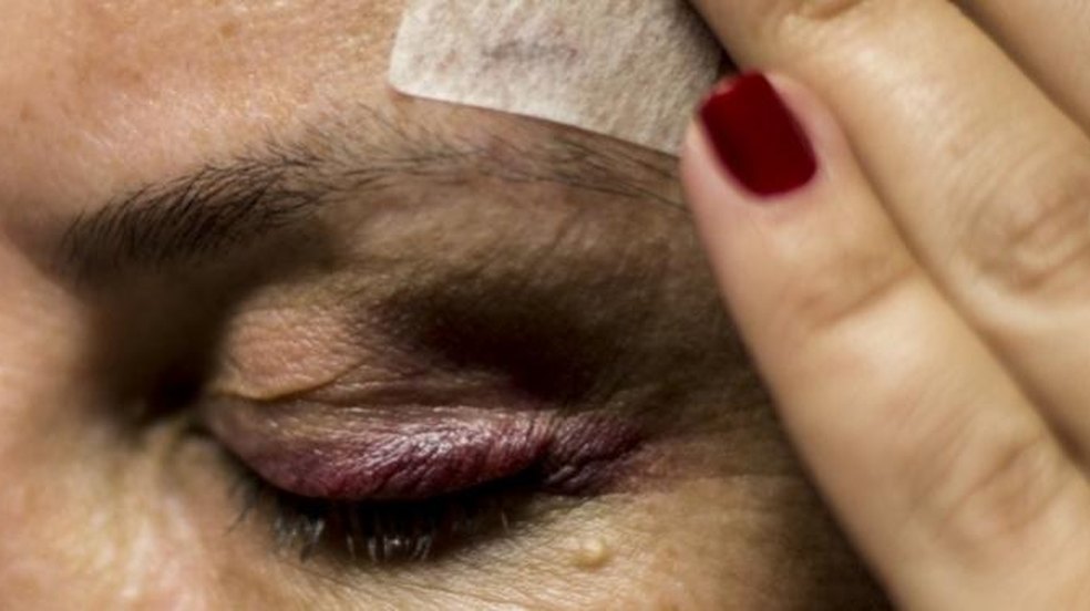Violência doméstica em condomínios
