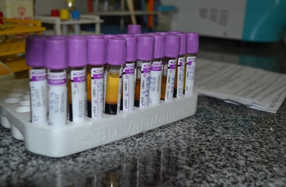 DOAÇÃO DE SANGUE HEMOSE / Foto: Ascom/SES
