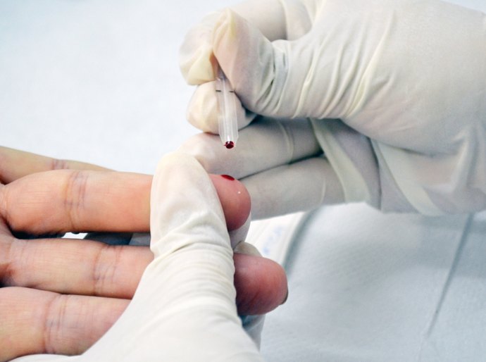 Helvio Auto fará testes para detectar HIV e sífilis abertos à população