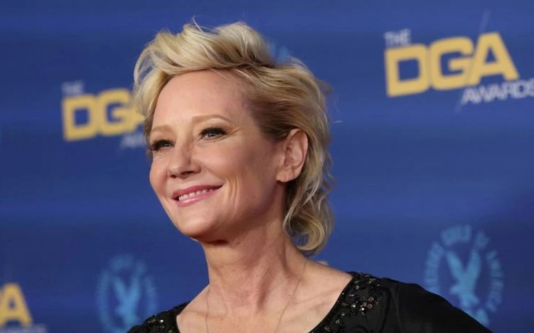 Estado de Anne Heche é &#8216;extremamente crítico&#8217;, diz agente da atriz