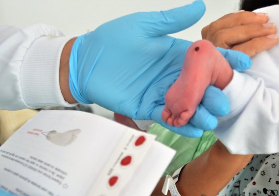 Pediatra da Sesau ressalta importância do Teste do Pezinho para diagnosticar sete doenças