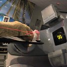 Santa Casa de Maceió oferece tratamento completo e individualizado para câncer de pulmão