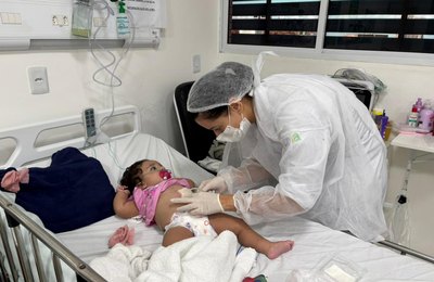 Enfermeiras do Hospital da Criança de Alagoas alertam sobre o que fazer em caso de queimaduras nas festas juninas