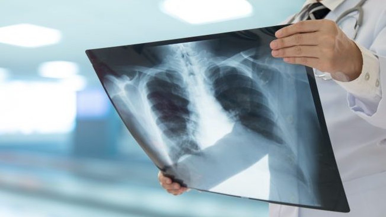 Comissão de Saúde debate incorporação da terapia tripla para tratamento da fibrose cística
