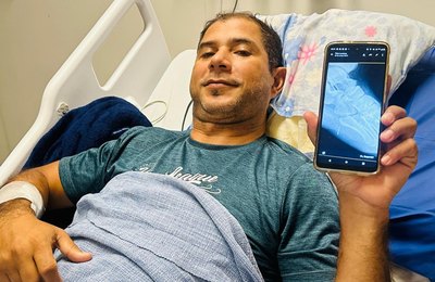 Homem é submetido à cirurgia após acidente com ferrão de peixe