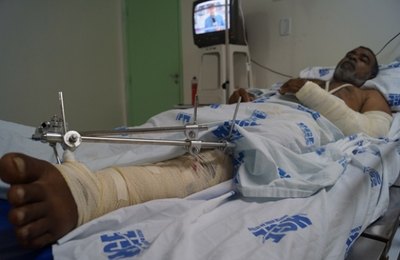 Duplica quantidade de cirurgias eletivas ortopédicas no HGE