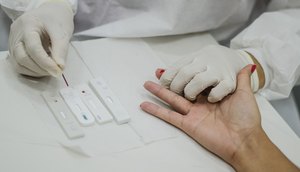 Testagem para diagnóstico de hepatites virais é ofertada em Sergipe; confira locais / Foto: Foto: SES/SE