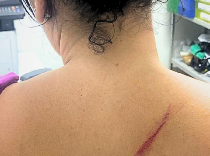 Homem é preso em flagrante por agressão à ex-companheira e filha de 8 anos em Arapiraca