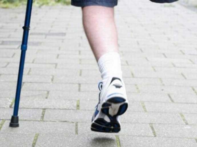 Acidentes de moto são a maior causa das amputações na Unidade do Agreste