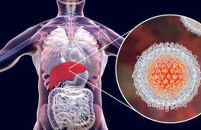 Julho Amarelo: Brasil registrou mais de 826 mil casos de hepatites virais; infectologista esclarece mitos e verdades sobre as doenças