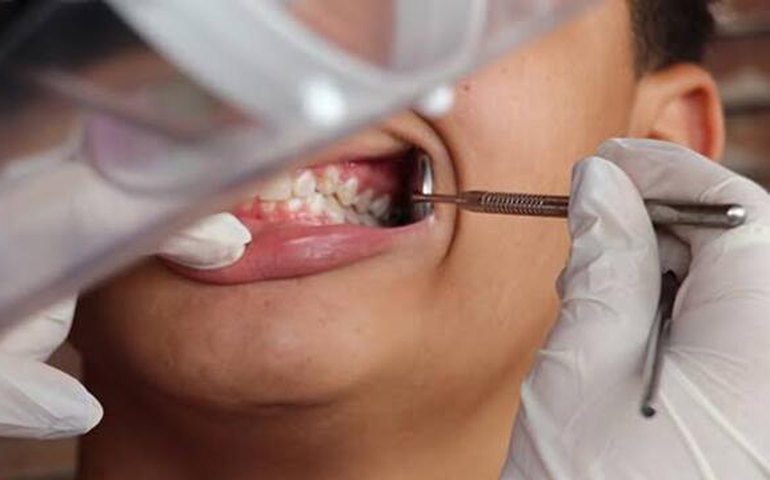 Prefeitura amplia número de equipes de saúde bucal e chega a quase 90% de cobertura em Arapiraca