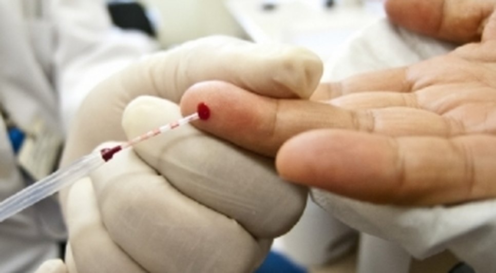 teste-sangue-HIV-aids--eex5p2615413-f3.jpg
