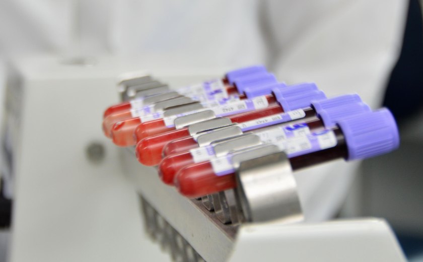 Hemoal cadastra doadores de medula óssea no Cesmac nesta sexta (15)