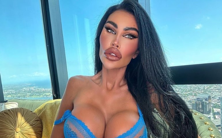 Barbies humanas gastam fortuna para se parecerem com boneca e visual impressiona