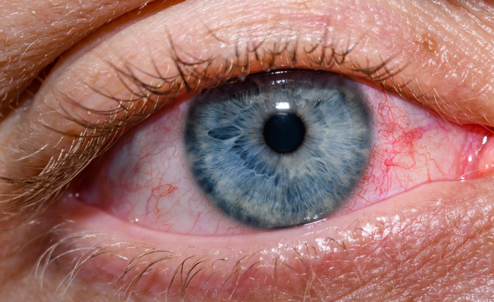 Nova moda nas redes sociais leva homens a raspar os cílios e preocupa especialistas que alertam para riscos à saúde ocular