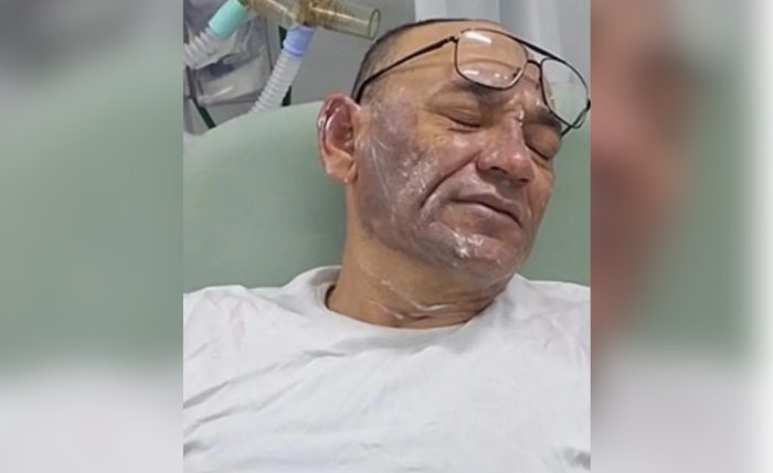 Policial foi socorrido após ser atingido com óleo fervente durante atendimento