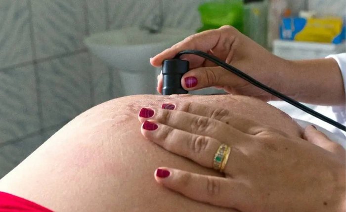 Parto normal é preferência das brasileiras, mas cesarianas predominam no país
