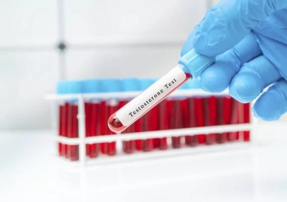 Andropausa: quais são os primeiros sinais da menopausa masculina