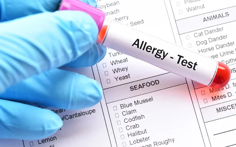 Alergias: associação alerta para risco nos testes de farmácia