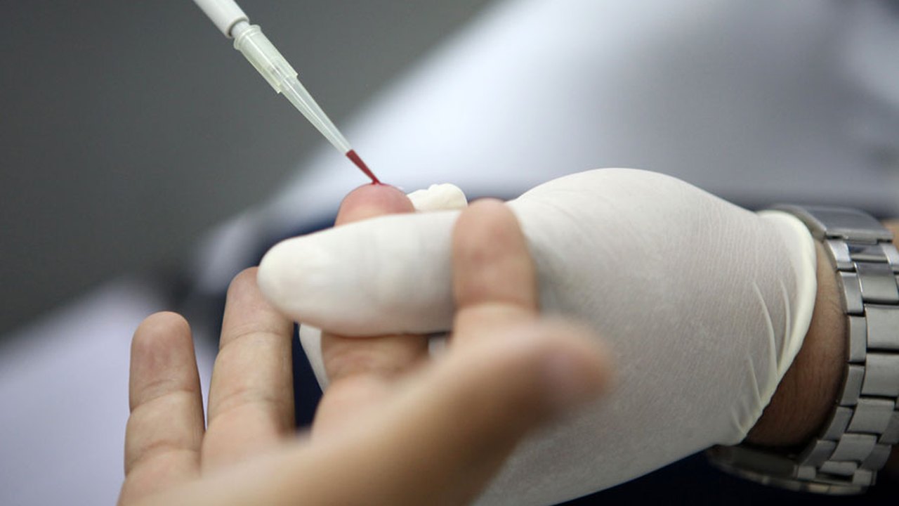 Esmal realiza 180 exames de DNA em Santana do Ipanema