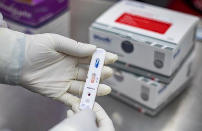 CNM solicita ao Ministério da Saúde regulação de preços de equipamentos e testes para a Covid-19