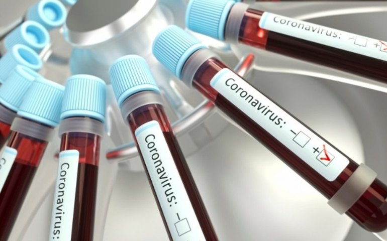 Pandemia derruba busca por tratamentos de fertilização