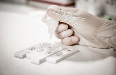 Saúde realiza testagem rápida para as hepatites virais