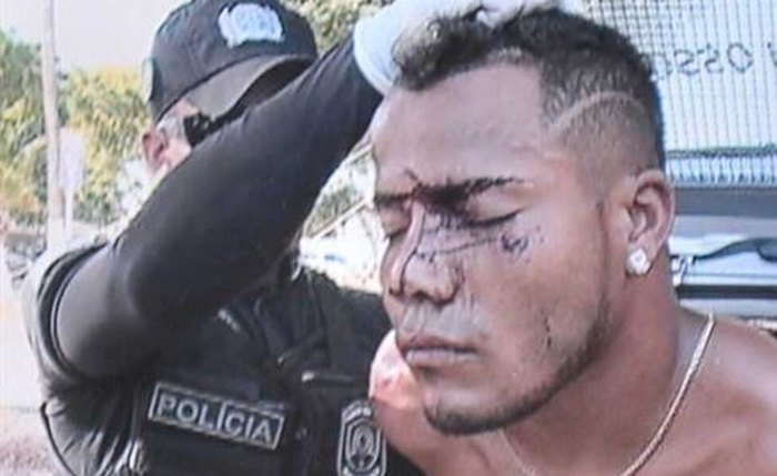 Robson foi agredido por outros moradores da região - Foto: divulgação