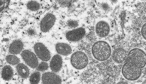 variola-macaco-20052022091640803.jpeg / Foto: CYNTHIA S. GOLDSMITH, RUSSELL REGNERY/CDC VIA REUTERS