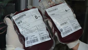 Sangue hemose