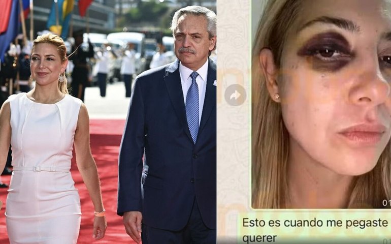 Fotos de ex-primeira-dama da Argentina com olho roxo e hematomas são reveladas após denúncia contra Fernández