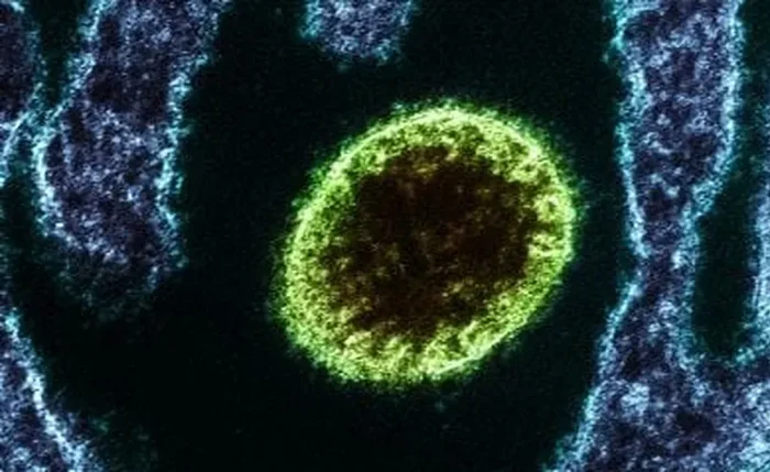 Vírus isolado Nipah observado em laboratório