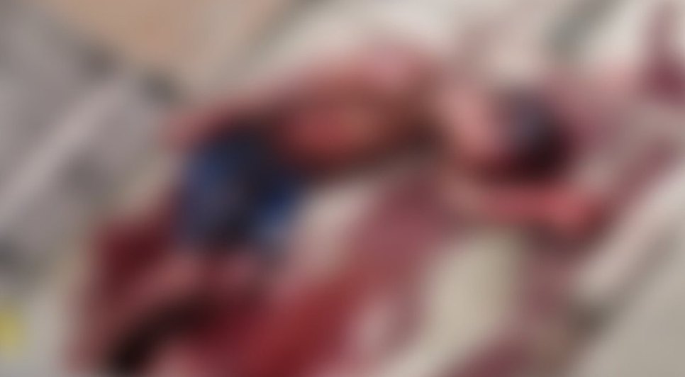Homem espancado por suspeita de roubo. Fonte: Internet