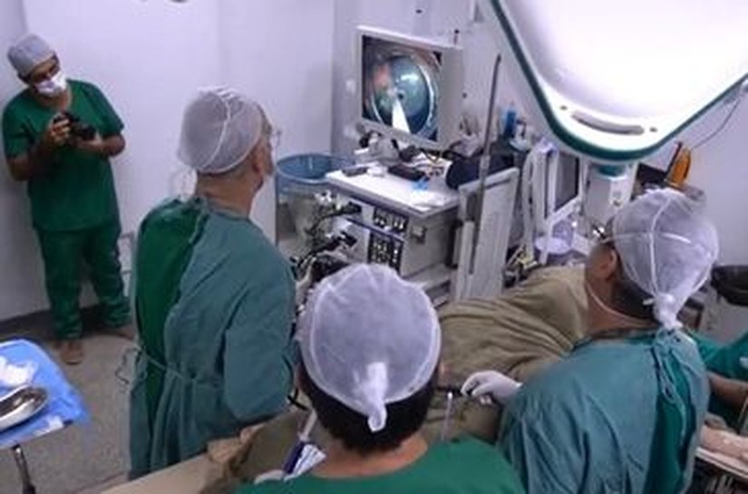 Mutirão reúne especialistas para tratar cerca de 70 pacientes com varizes de esôfago e gástricas em Maceió