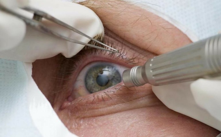 Rio ganha unidade pública dedicada a tratamentos oftalmológicos