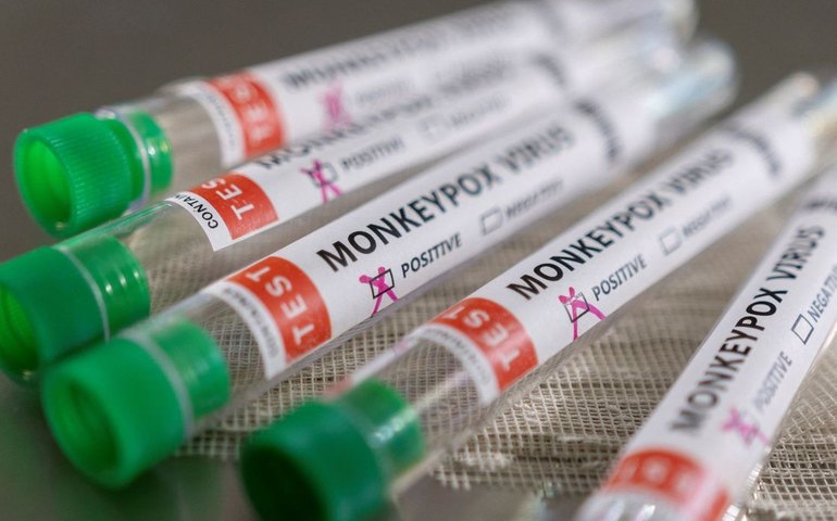 Mpox: Europa prevê mais casos de nova variante nas próximas semanas